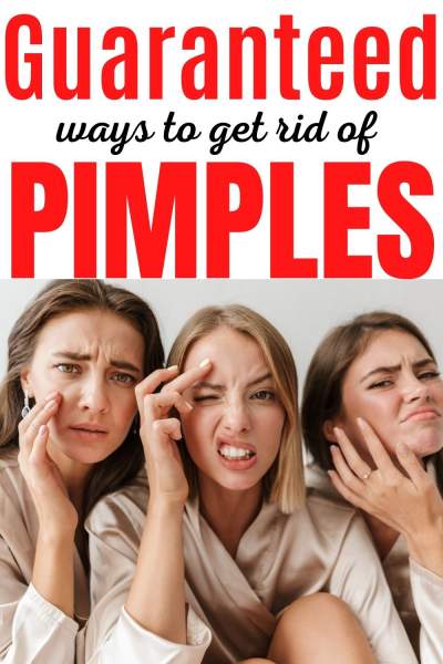 Guaranteed Ways to get rid of Pimples